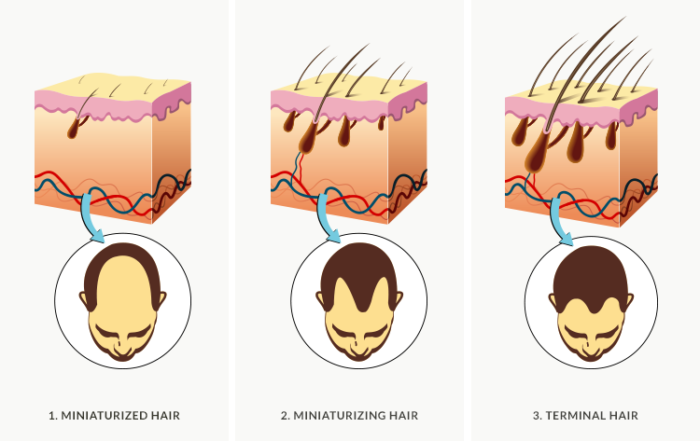 hair transplantation, hair transplantation dubai, hair transplantation clinic in dubai