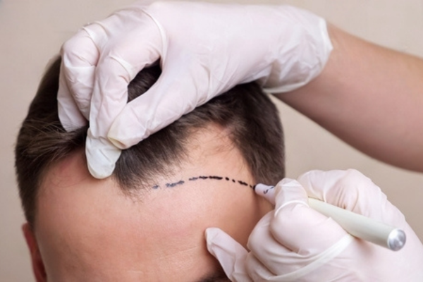 The Art and Science Of A Hair Line Design