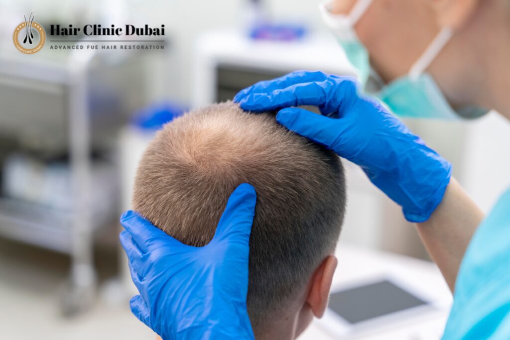 hair transplant uses, hair clinic dubai, hair transplant clinic in Dubai
