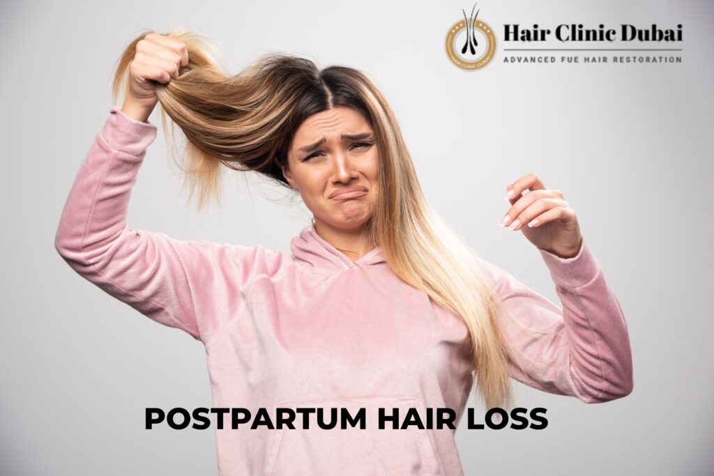 postpartum hair loss solutions dubai, female hair loss dubai, hair clinic dubai