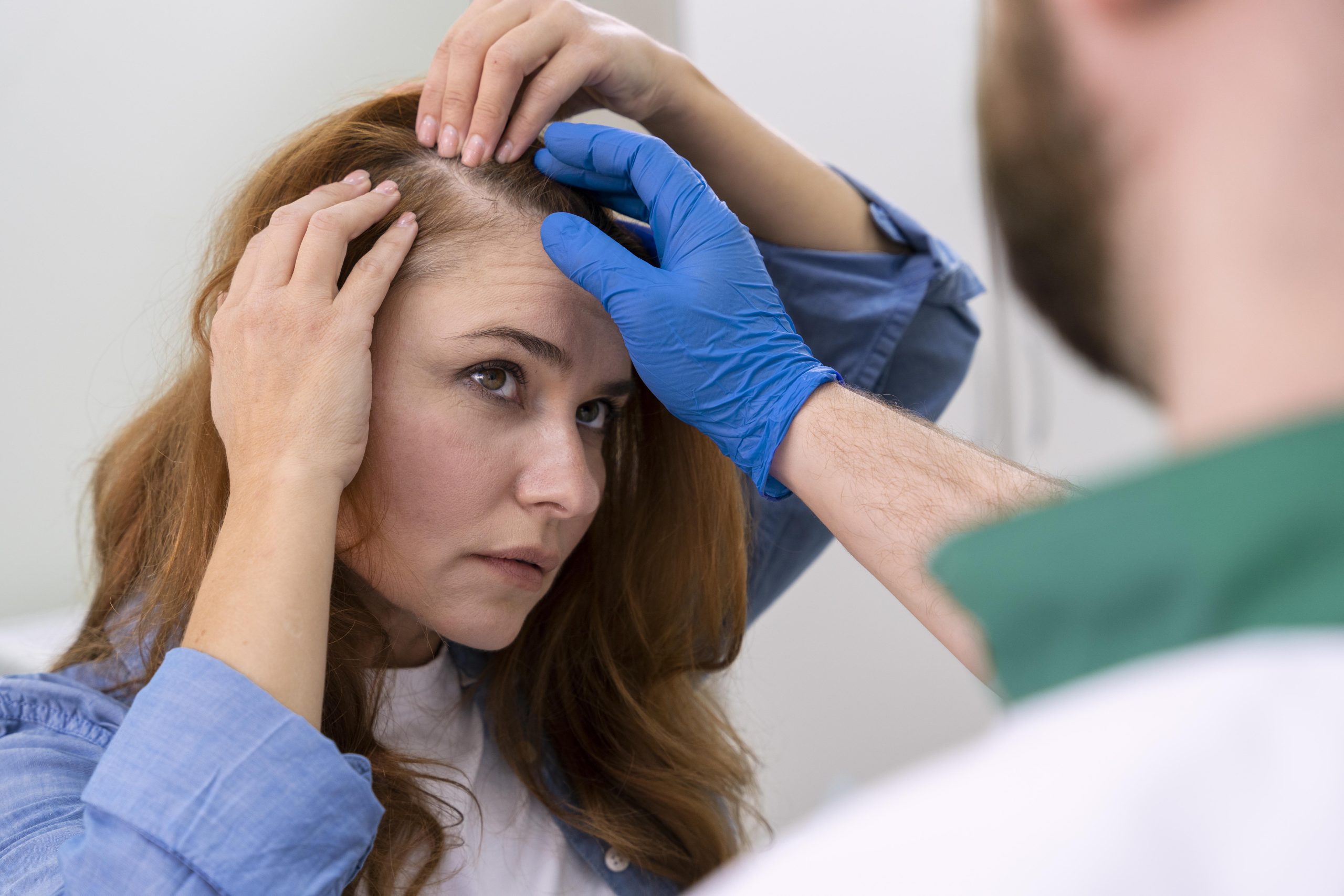 female hair loss treatment dubai