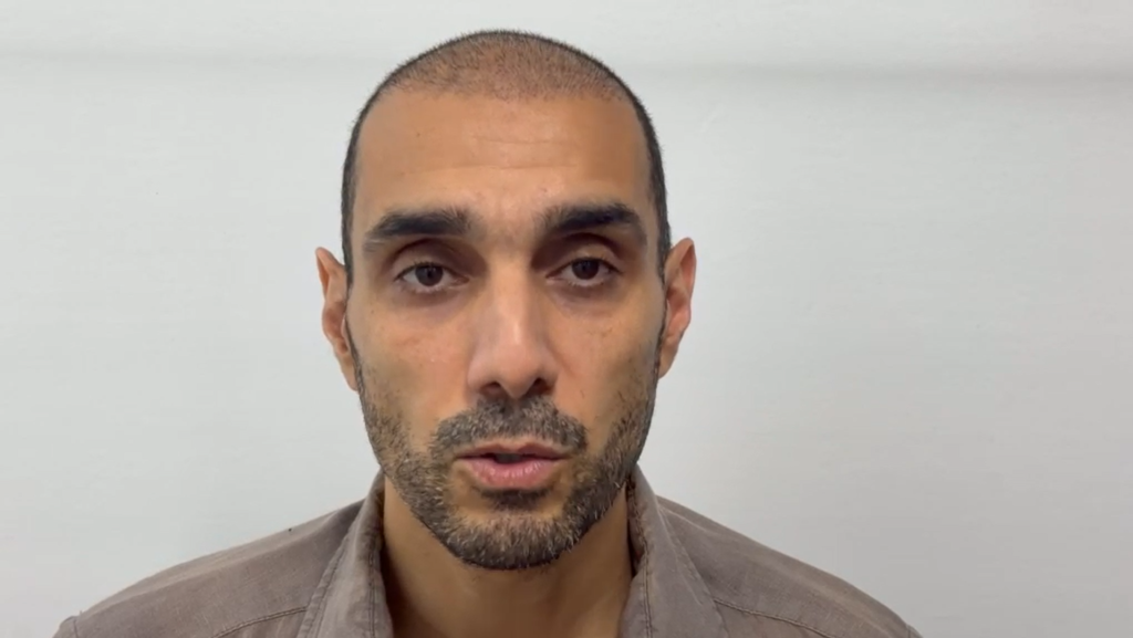 Hair transplant recovery after 2 weeks at Hair Clinic Dubai