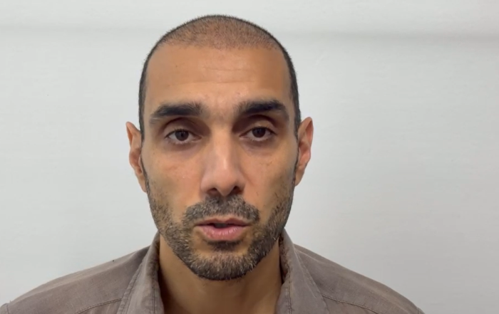 Hair transplant recovery after 2 weeks at Hair Clinic Dubai